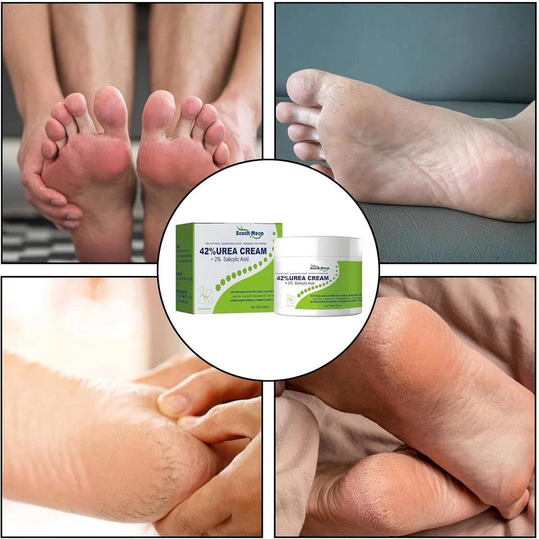 South Moon - 42% Urea Cream + 2% Salicylic Acid (Original)